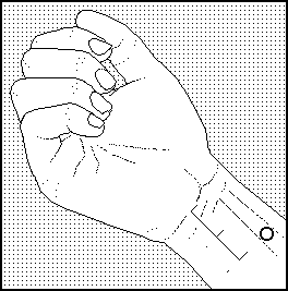 Acupunctuurpunt 2 onderkant onderarm painzap bijnbestrijding pen