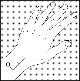 Acupunctuurpunt 3 bovenkant onderarm pain zap bijnbestrijding pen