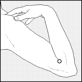 Acupunctuurpunt 8 zijkant elleboog pain zap bijnbestrijding pen
