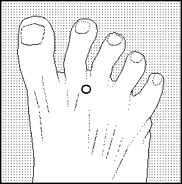 Acupunctuurpunt 22 voet tenen pain zap bijnbestrijding pen