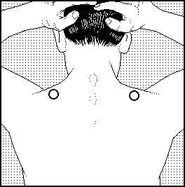 Acupunctuurpunt 27 trapezius pain zap bijnbestrijding pen