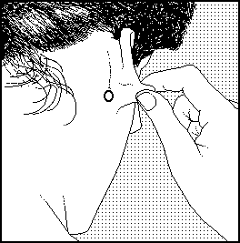 Acupunctuurpunt 29 oor pain zap bijnbestrijding pen